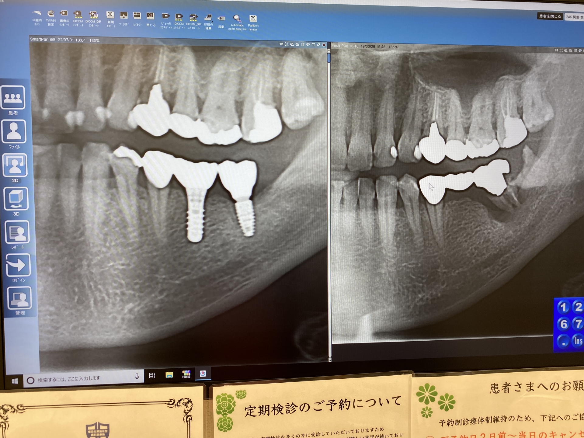 【 ７８１ 】  使用前・使用後～２年かかりました～